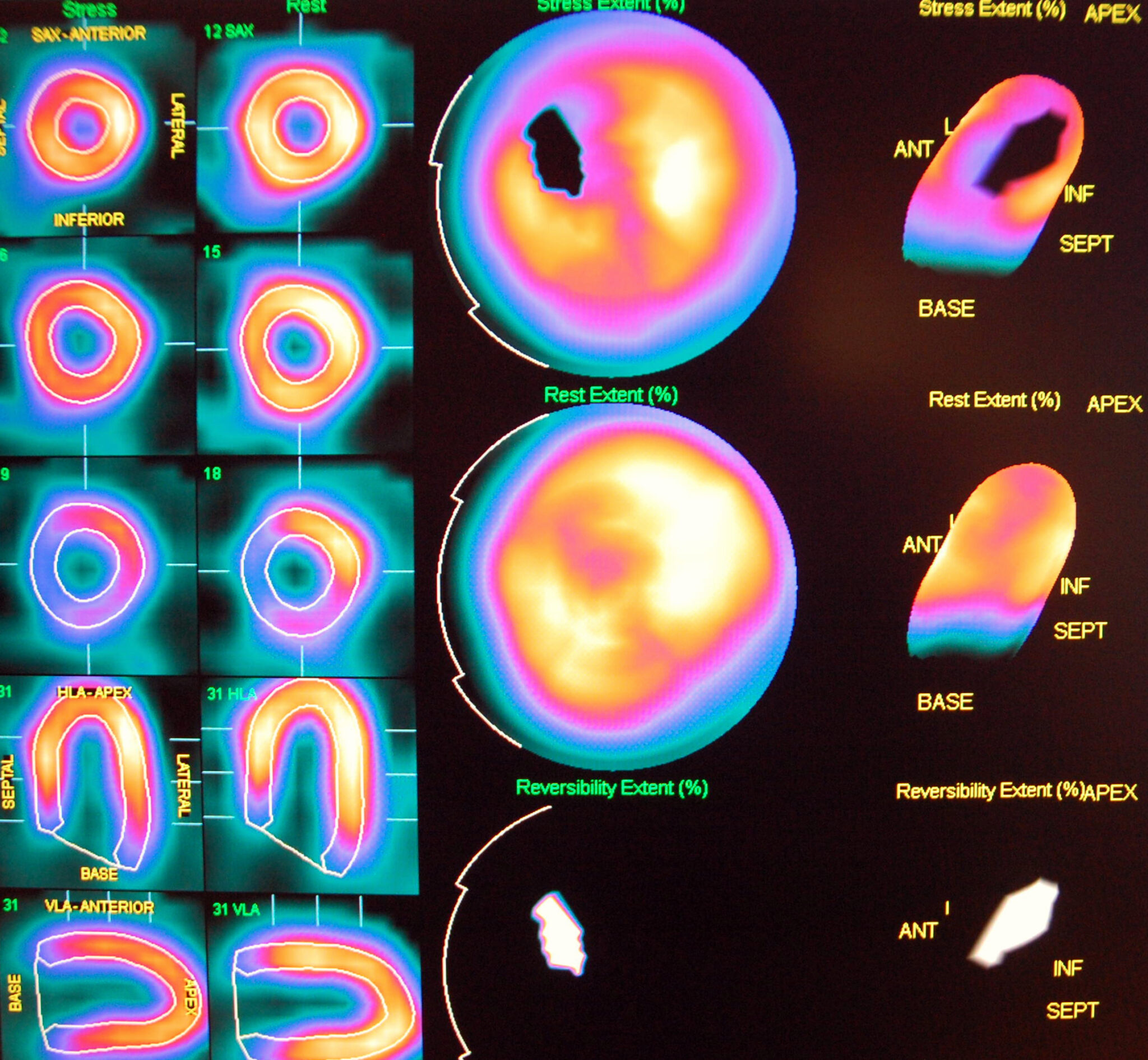 How to Prepare for the Nuclear Cardiology Boards