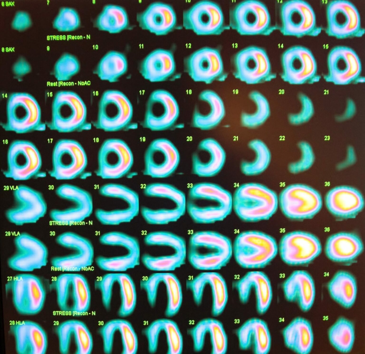 5 Top Books for the Nuclear Cardiology Boards BoardVitals