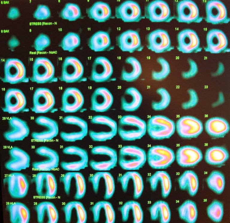 5 Top Books For The Nuclear Cardiology Boards - BoardVitals