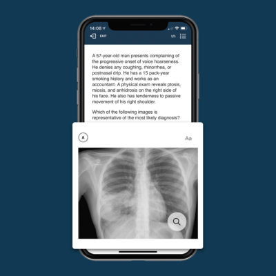 boardvitals usmle® step 1 question bank radiological images