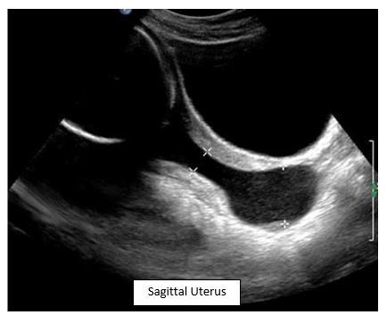 preterm delivery radiology core